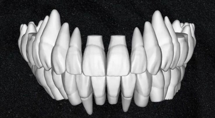 The complete set of - 34 Grin Design dental libraries - Exocad Low-poly 3D model_29