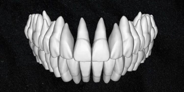 The complete set of - 34 Grin Design dental libraries - Exocad Low-poly 3D model_28