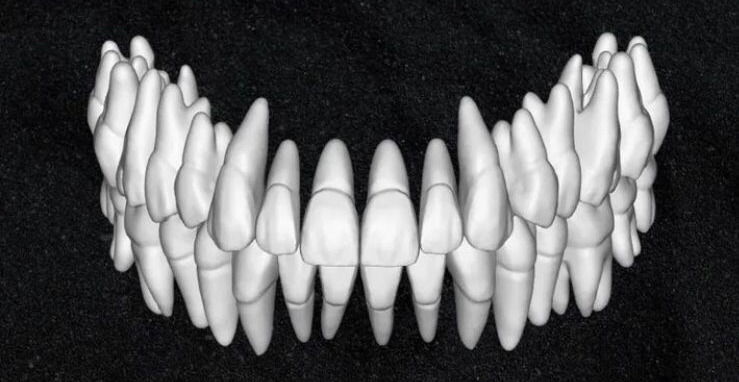 The complete set of - 34 Grin Design dental libraries - Exocad Low-poly 3D model_33