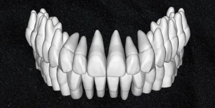 The complete set of - 34 Grin Design dental libraries - Exocad Low-poly 3D model_35