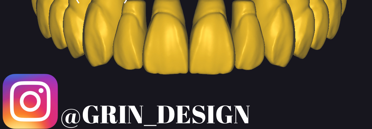 The complete set of - 34 Grin Design dental libraries - Exocad Low-poly 3D model_10