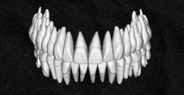 The complete set of - 34 Grin Design dental libraries - Exocad Low-poly 3D model_30