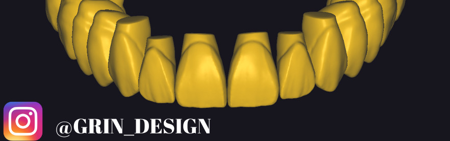 The complete set of - 34 Grin Design dental libraries - Exocad Low-poly 3D model_14