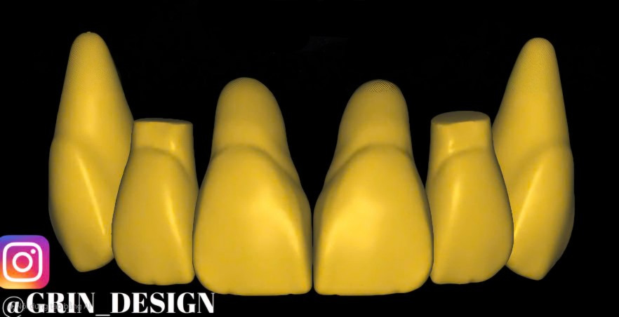 The complete set of - 34 Grin Design dental libraries - Exocad Low-poly 3D model_4