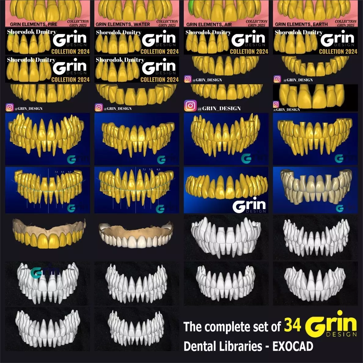 The complete set of - 34 Grin Design dental libraries - Exocad Low-poly 3D model_0