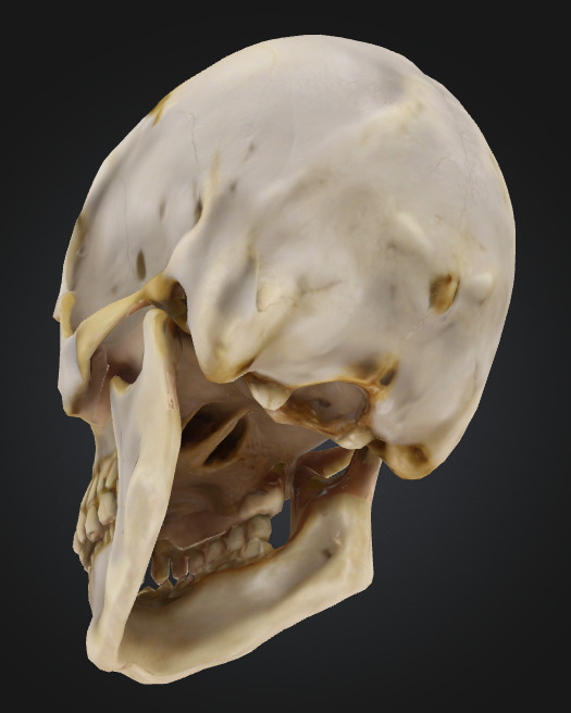 Realistic Human Skull 3D Printable Model 3D print model_3