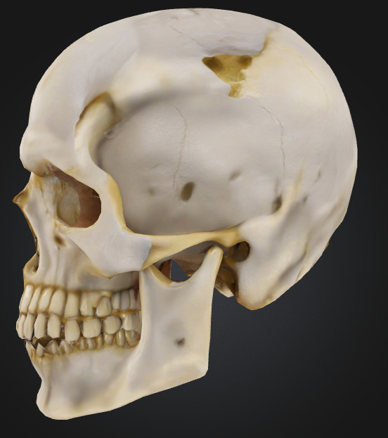Realistic Human Skull 3D Printable Model 3D print model_4