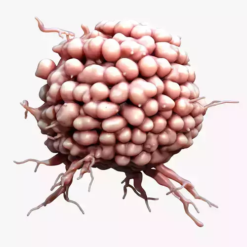 Cancer Cell Tumor