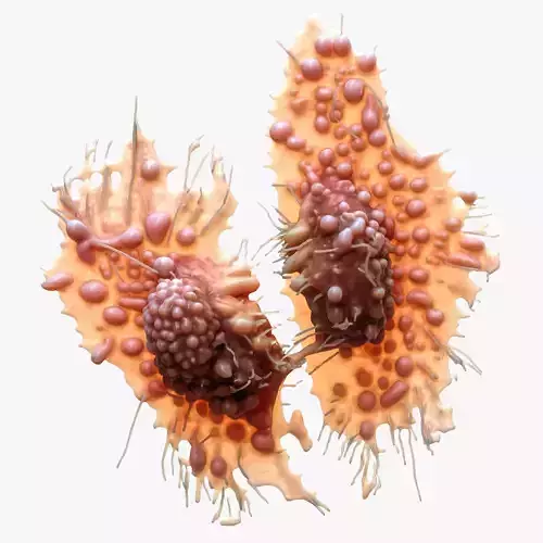 Cancer Cell Tumor