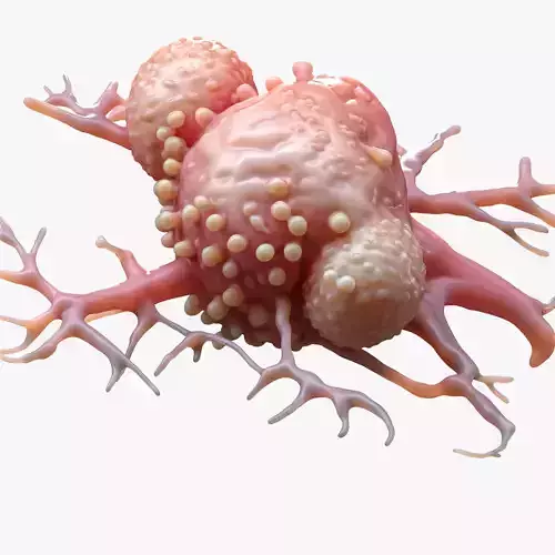 Cancer Cell Tumor