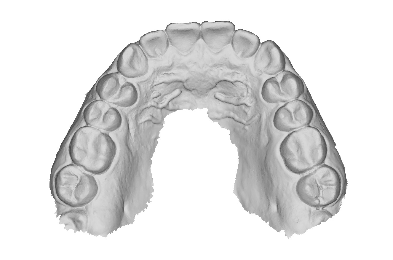 P016 - Dental - Intraoral Scan STL-PLY-OBJ 3D print model_1
