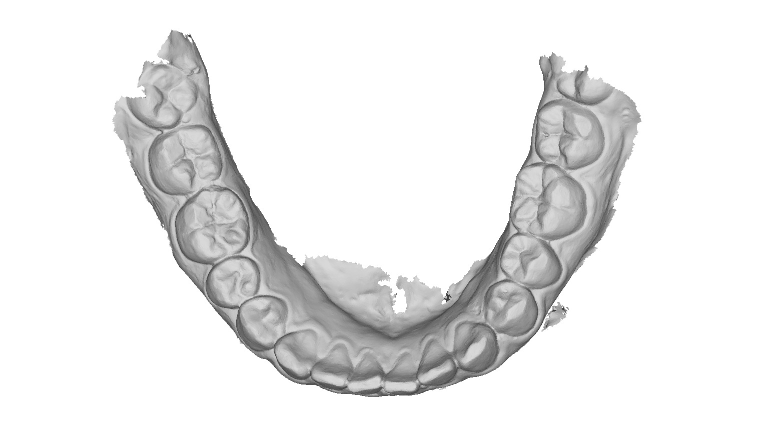 P016 - Dental - Intraoral Scan STL-PLY-OBJ 3D print model_2