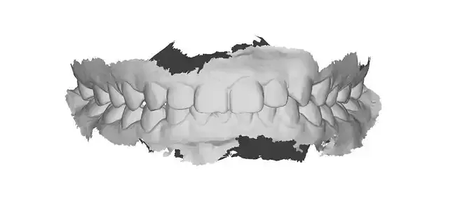 P016 - Dental - Intraoral Scan STL-PLY-OBJ