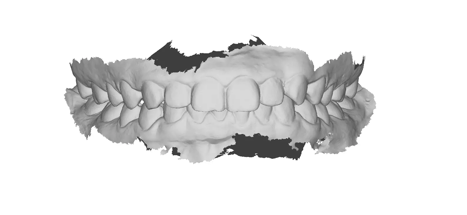 P016 - Dental - Intraoral Scan STL-PLY-OBJ 3D print model_0