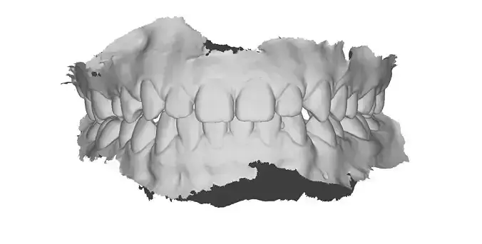 P019 - Dental - Intraoral Scan STL-PLY-OBJ