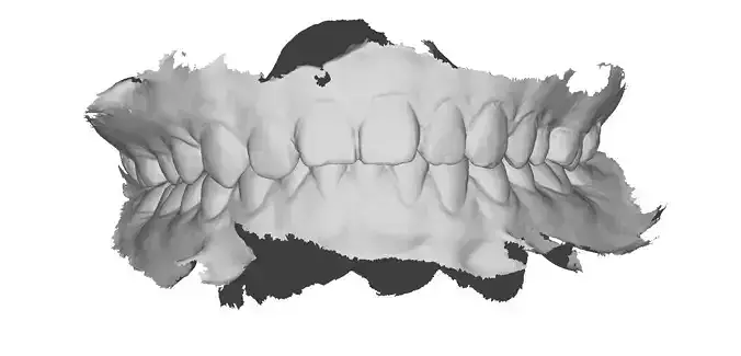 P021 - Dental - Intraoral Scan STL-PLY-OBJ
