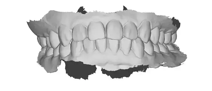 P027 - Dental - Intraoral Scan STL-PLY-OBJ 3D print model