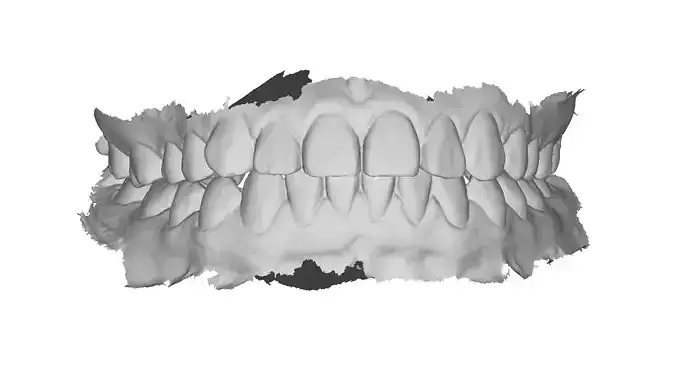 P031 - Dental - Intraoral Scan STL-PLY-OBJ 3D print model