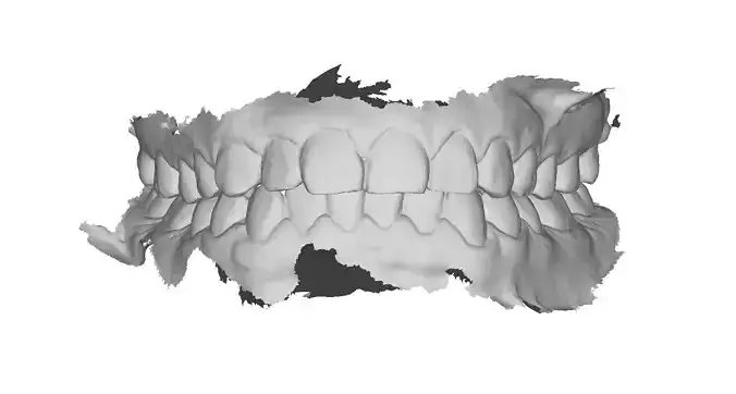 P036 - Dental - Intraoral Scan STL-PLY-OBJ