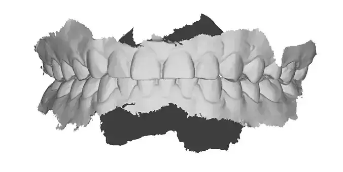 P038 - Dental - Intraoral Scan STL-PLY-OBJ