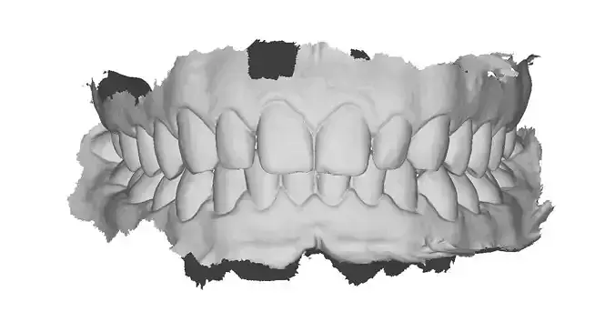 P042 - Dental - Intraoral Scan STL-PLY-OBJ 3D print model