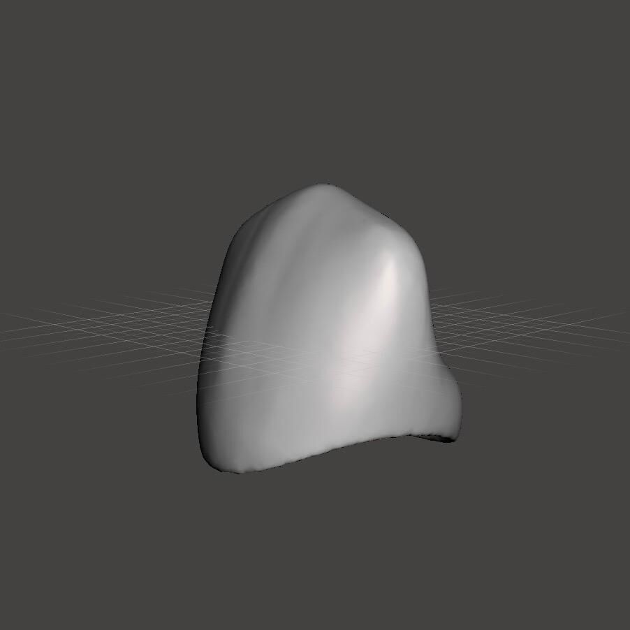  Pediatric readymade crowns Upper Primary Cuspid  3D print model_1