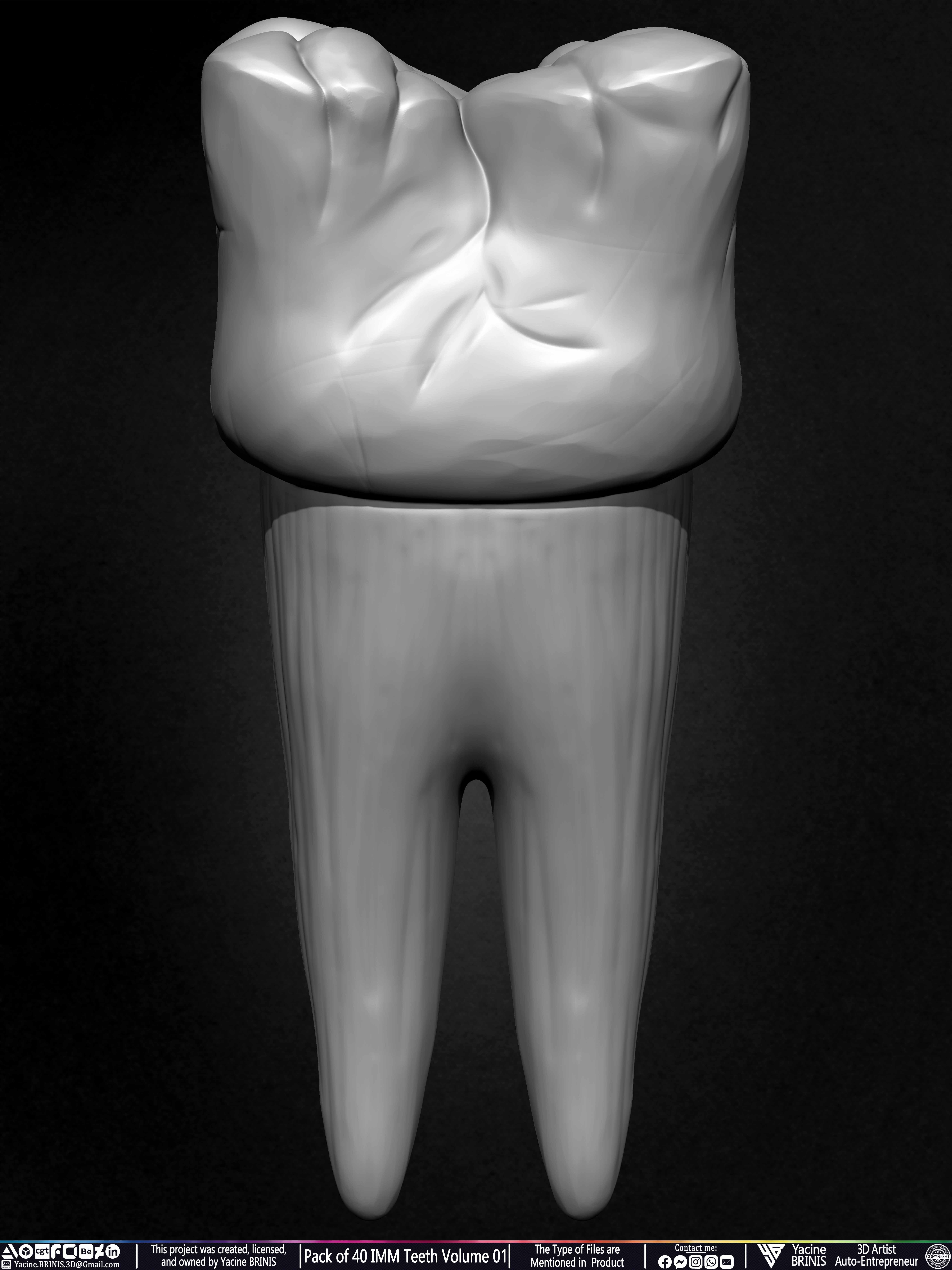 Pack of 40 IMM Teeth Volume 01 3D model_41