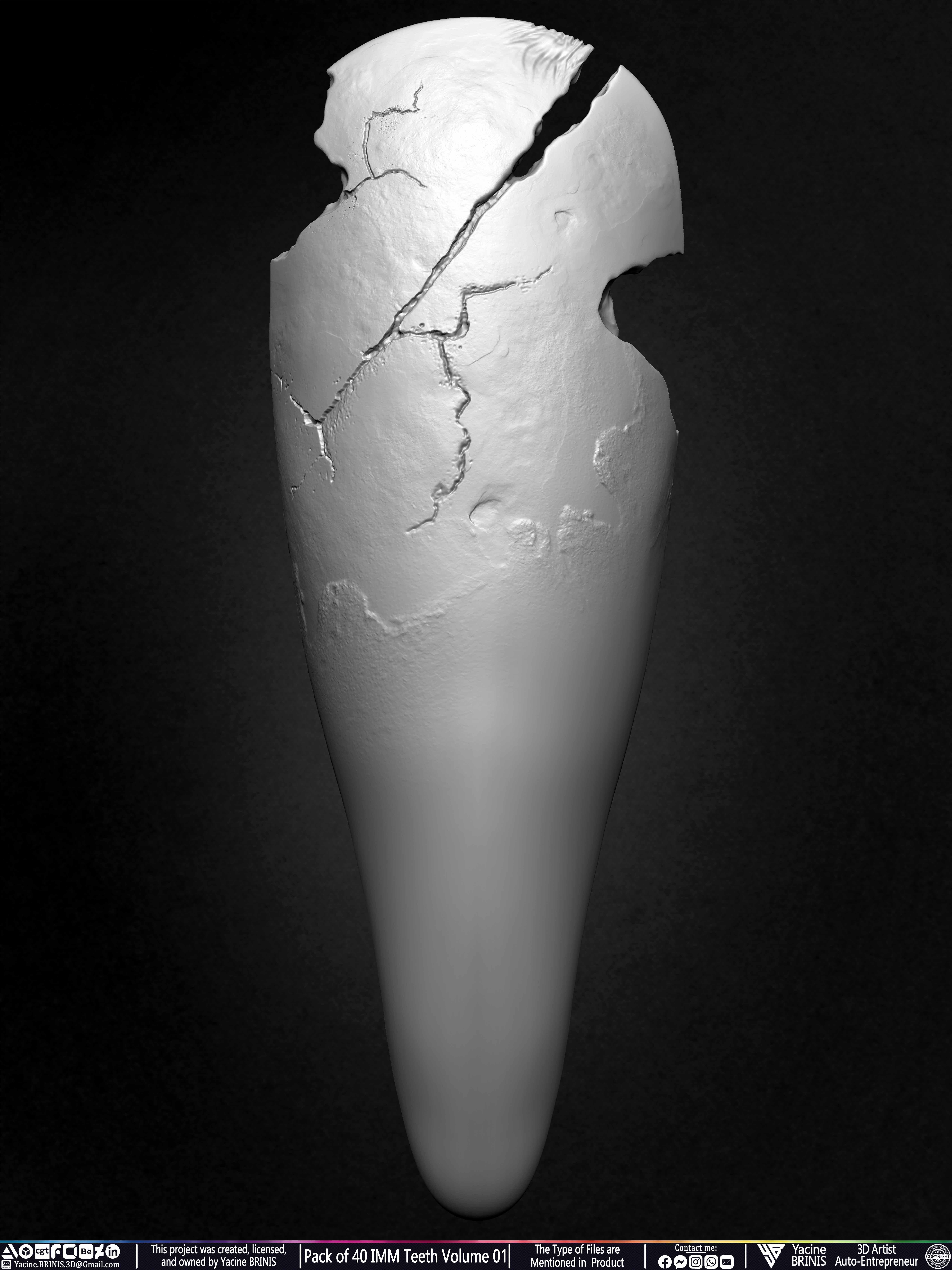 Pack of 40 IMM Teeth Volume 01 3D model_30