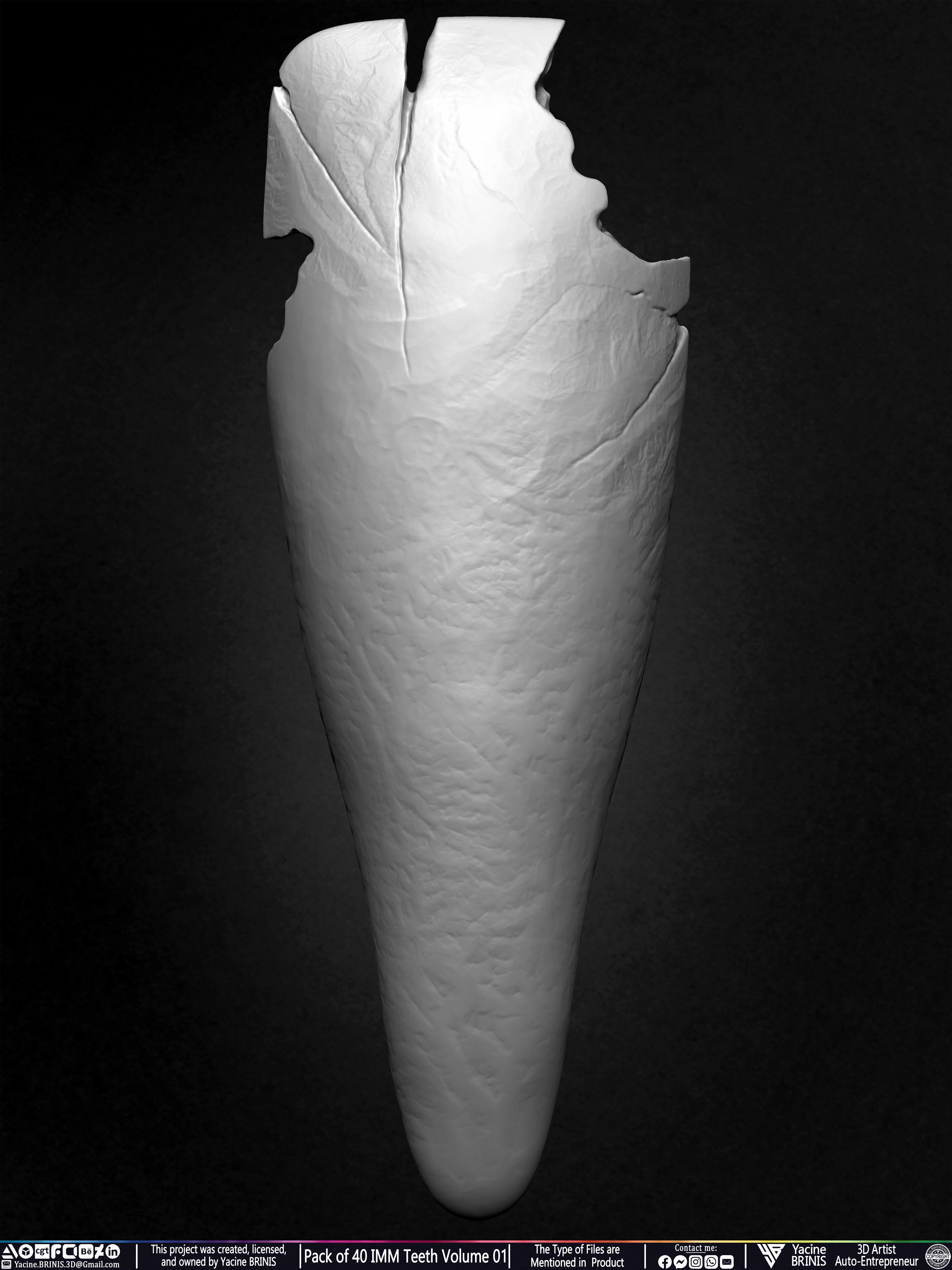 Pack of 40 IMM Teeth Volume 01 3D model_28