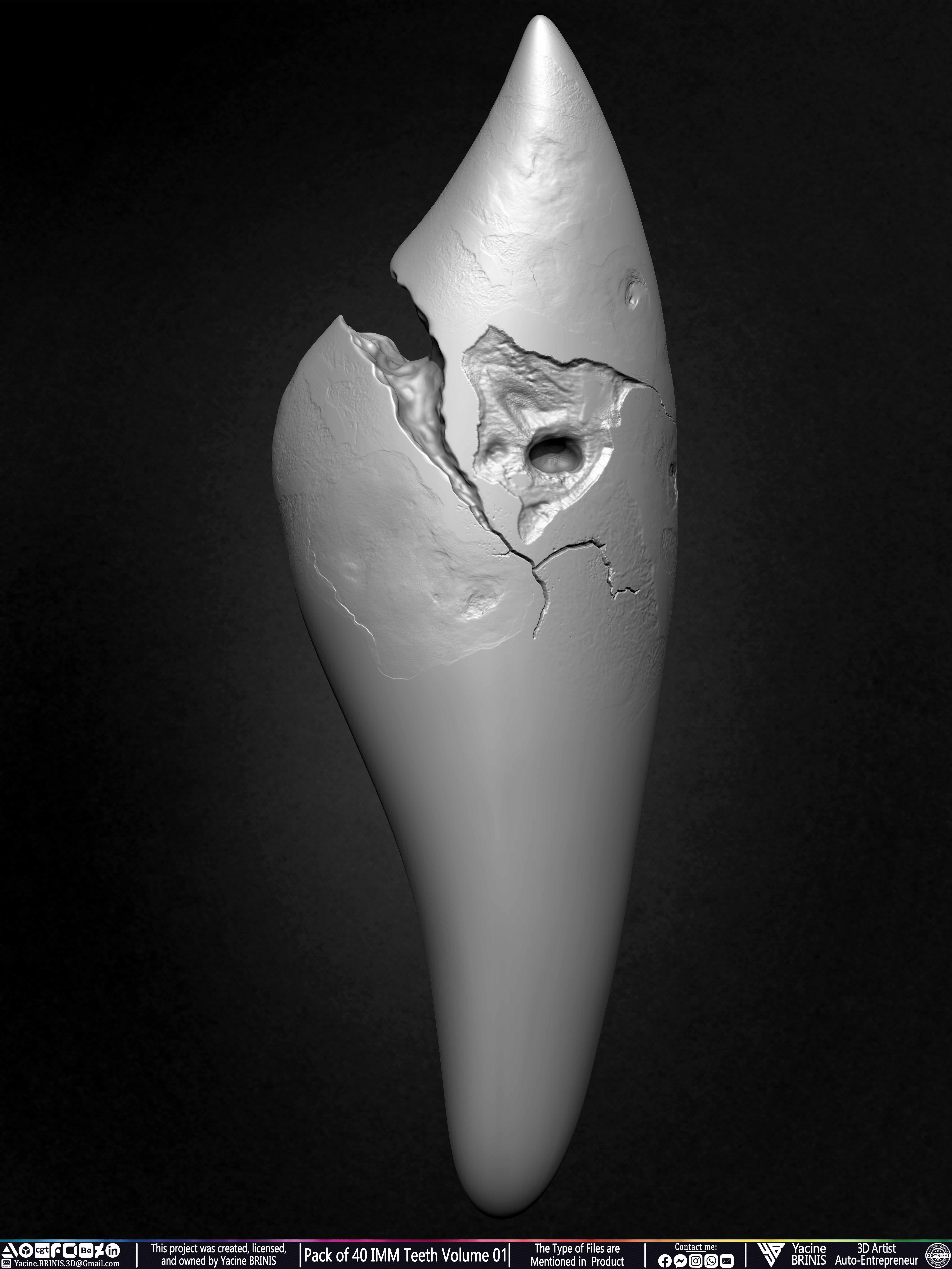 Pack of 40 IMM Teeth Volume 01 3D model_32