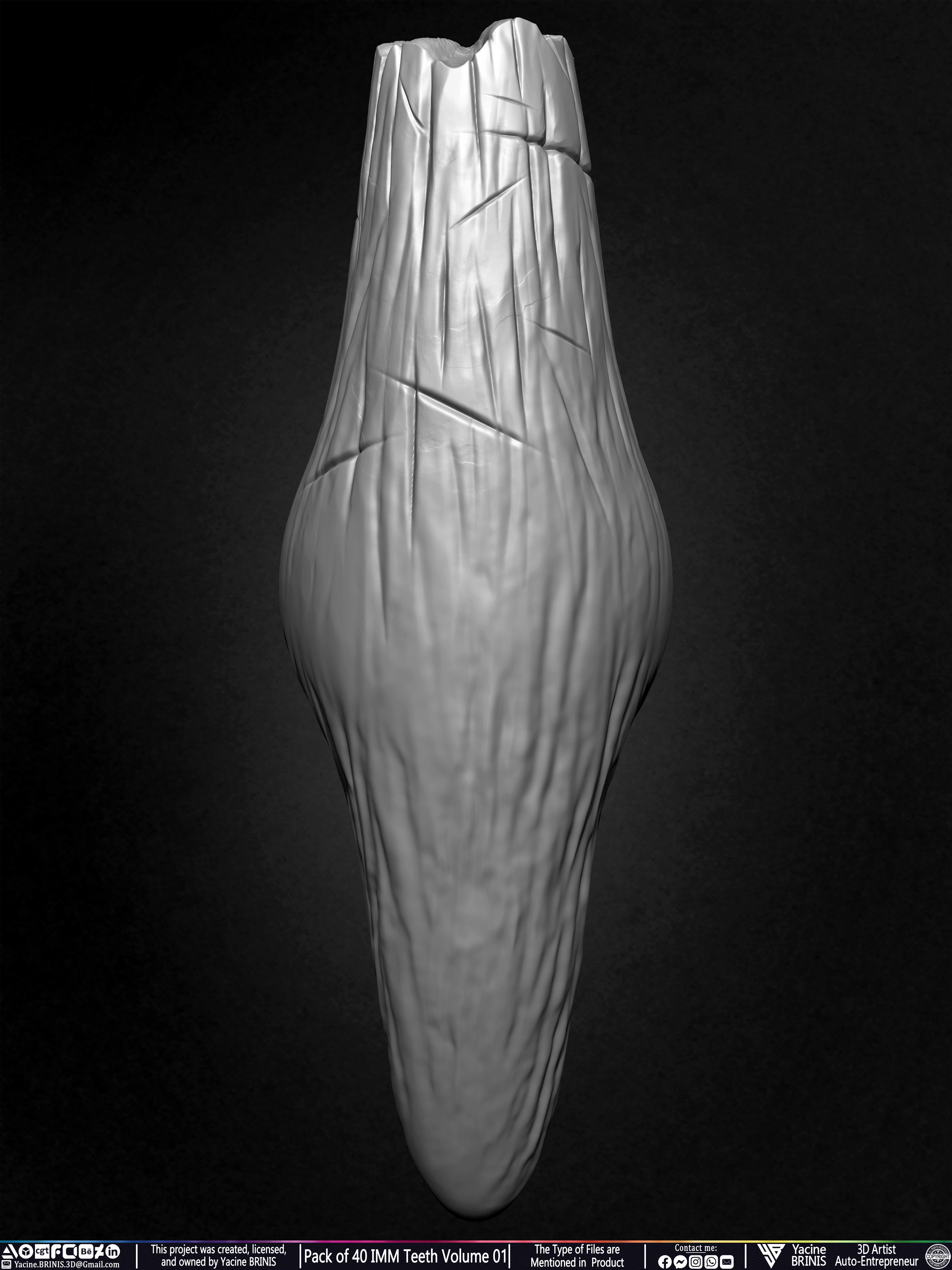 Pack of 40 IMM Teeth Volume 01 3D model_47