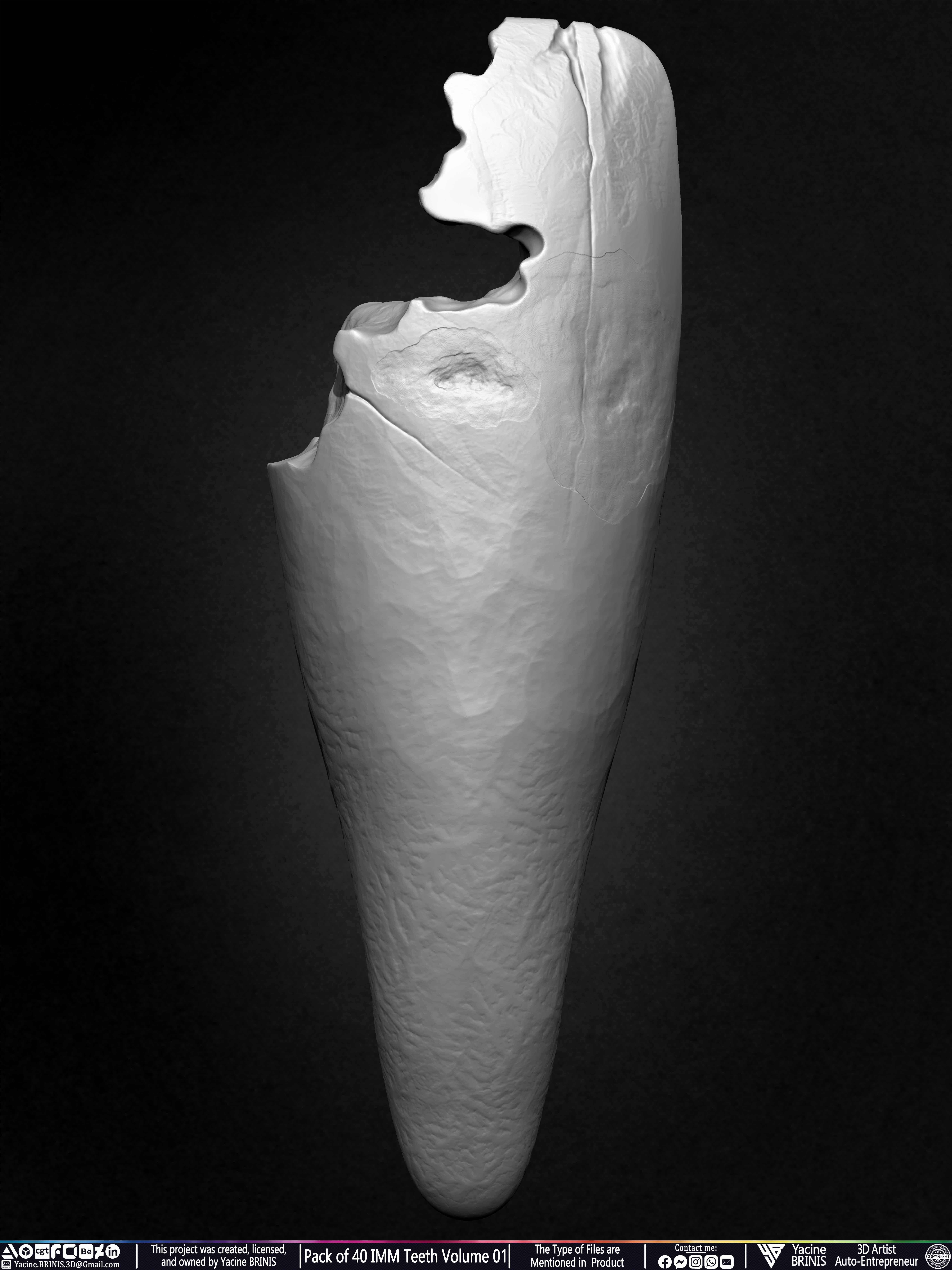 Pack of 40 IMM Teeth Volume 01 3D model_29