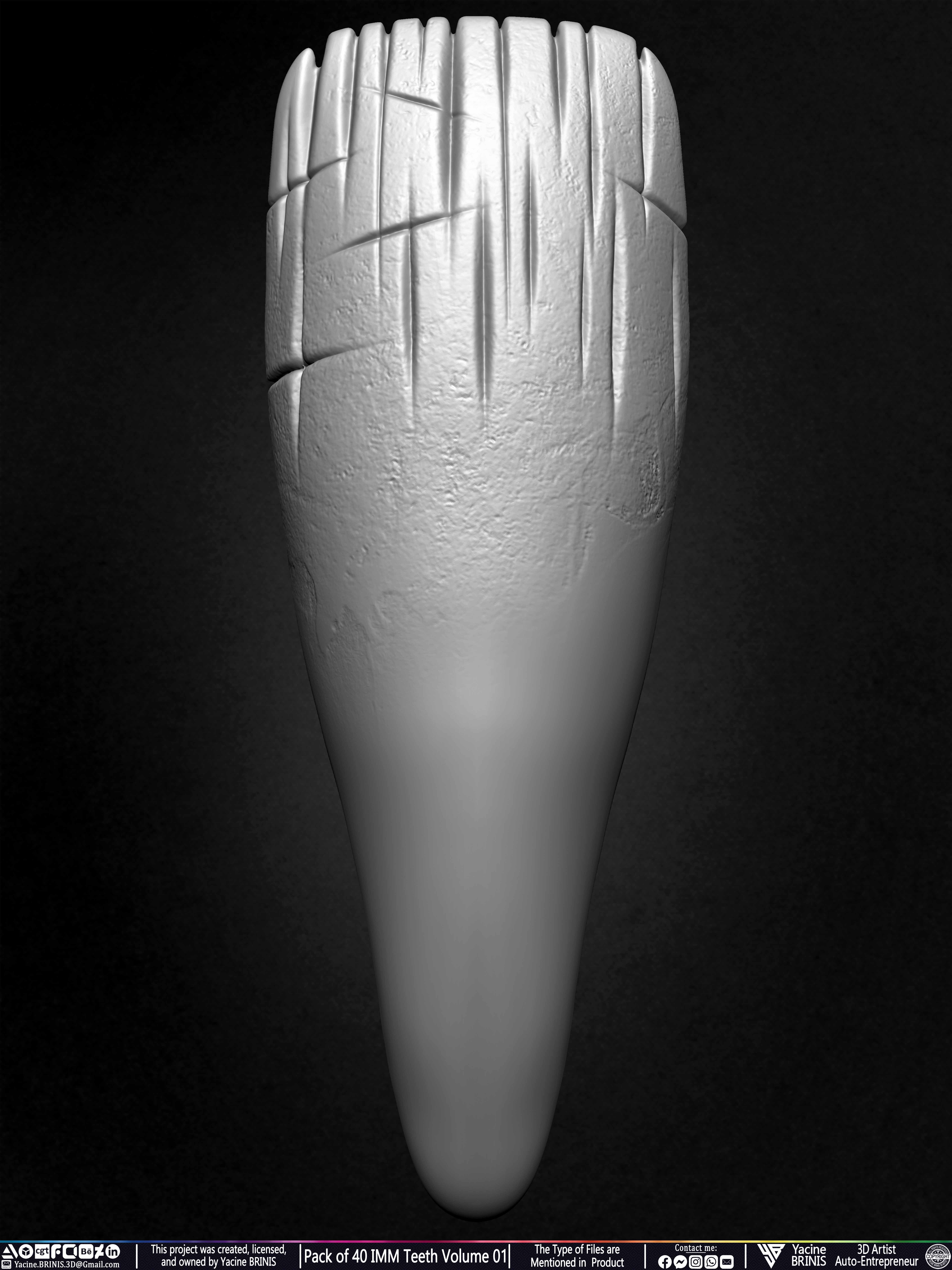 Pack of 40 IMM Teeth Volume 01 3D model_48