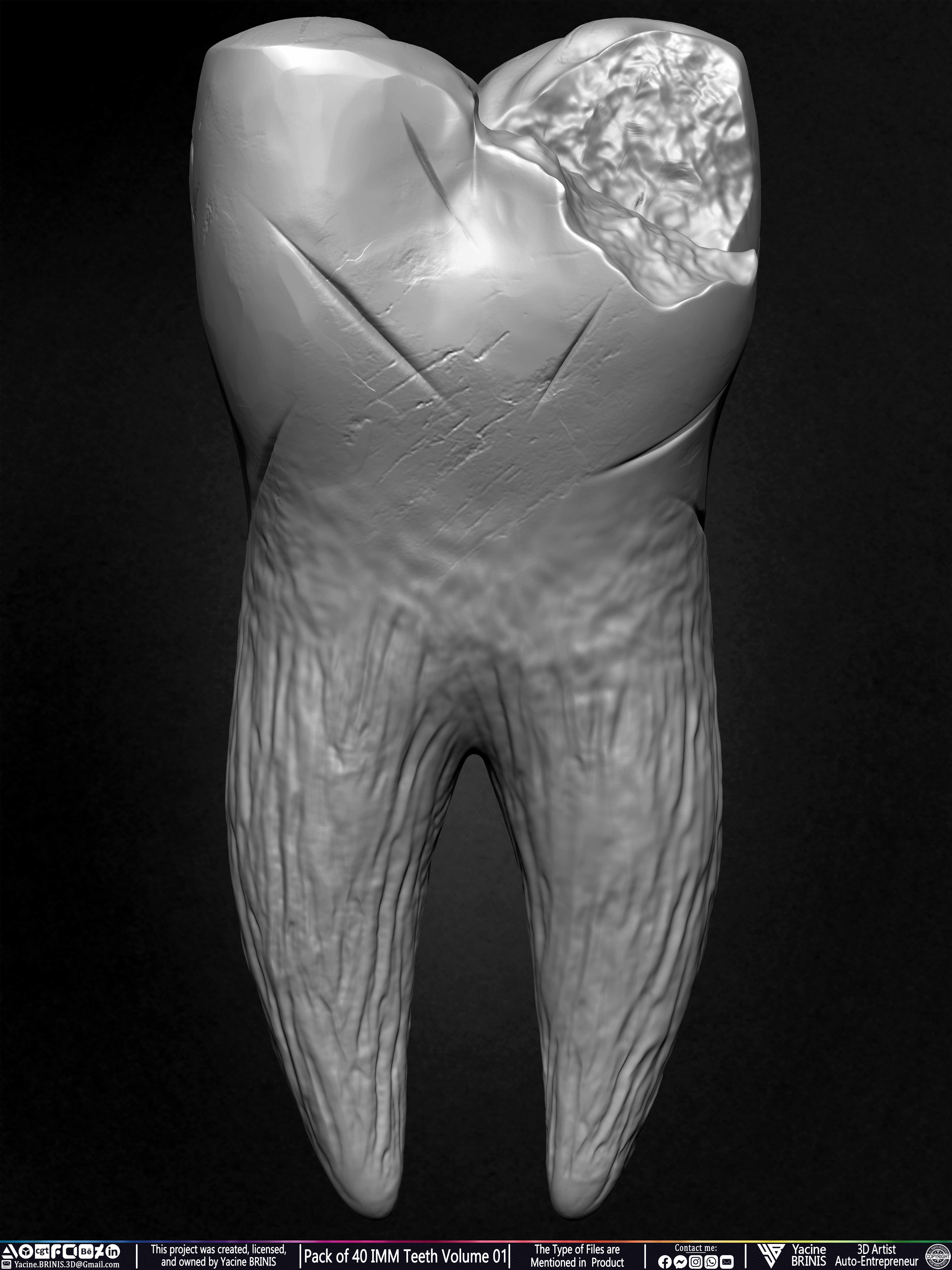 Pack of 40 IMM Teeth Volume 01 3D model_43