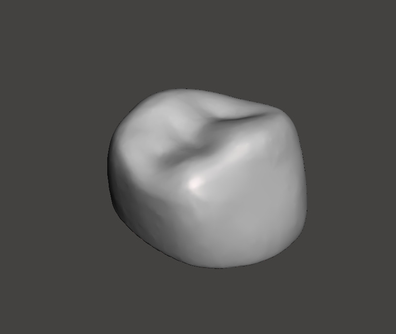 Dental Pediatric readymade crowns milling With Cuspid Set 3D print model_8