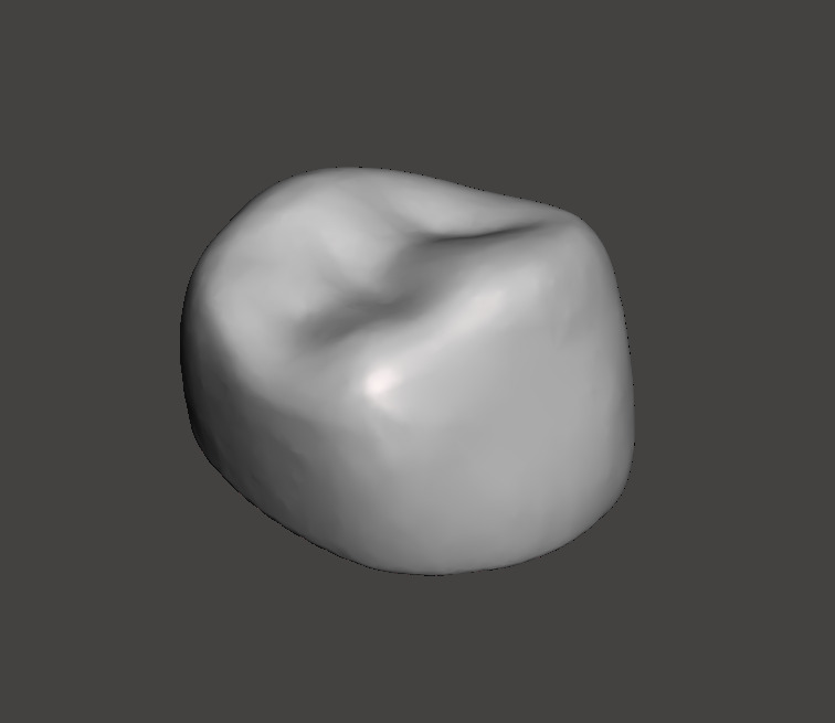 Dental Pediatric readymade crowns milling With Cuspid Set 3D print model_10