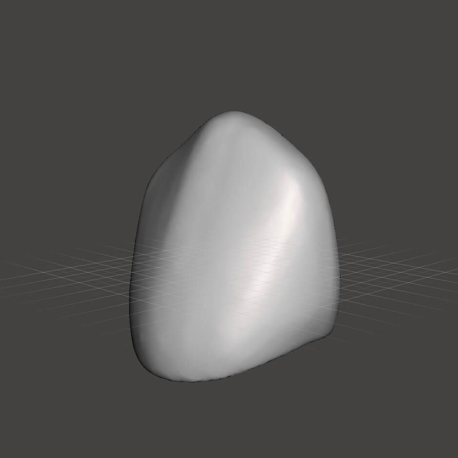 Dental Pediatric readymade crowns milling With Cuspid Set 3D print model_13