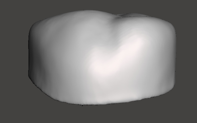 Dental Pediatric readymade crowns milling With Cuspid Set 3D print model_6