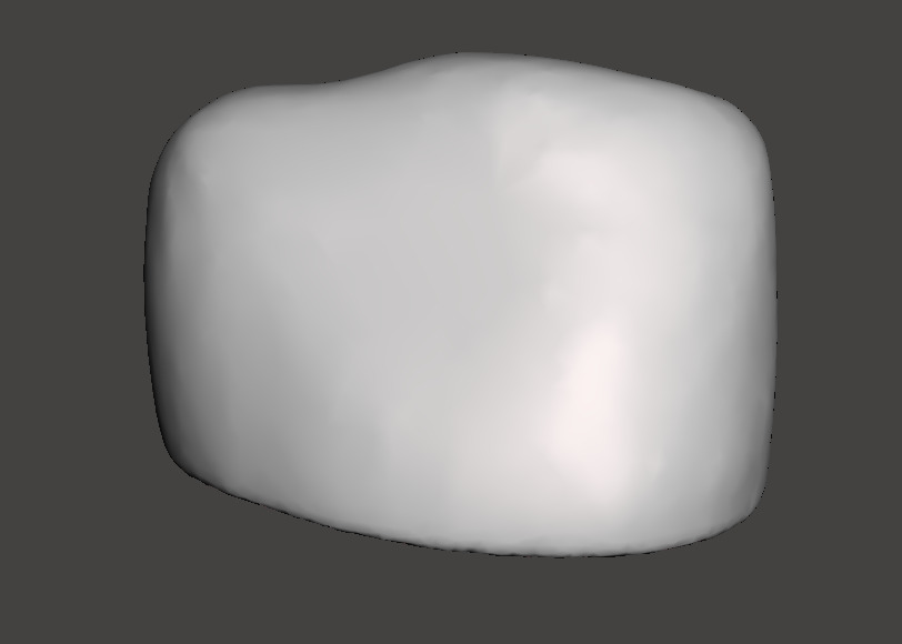 Dental Pediatric readymade crowns milling With Cuspid Set 3D print model_4