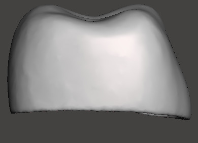 Dental Pediatric readymade crowns milling With Cuspid Set 3D print model_5