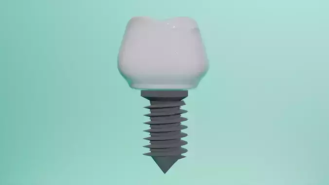Implant made for dental animation
