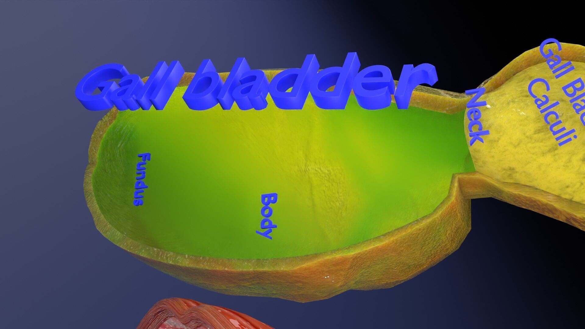 Biliary tract stone obstructions gallstone Low-poly 3D model_10