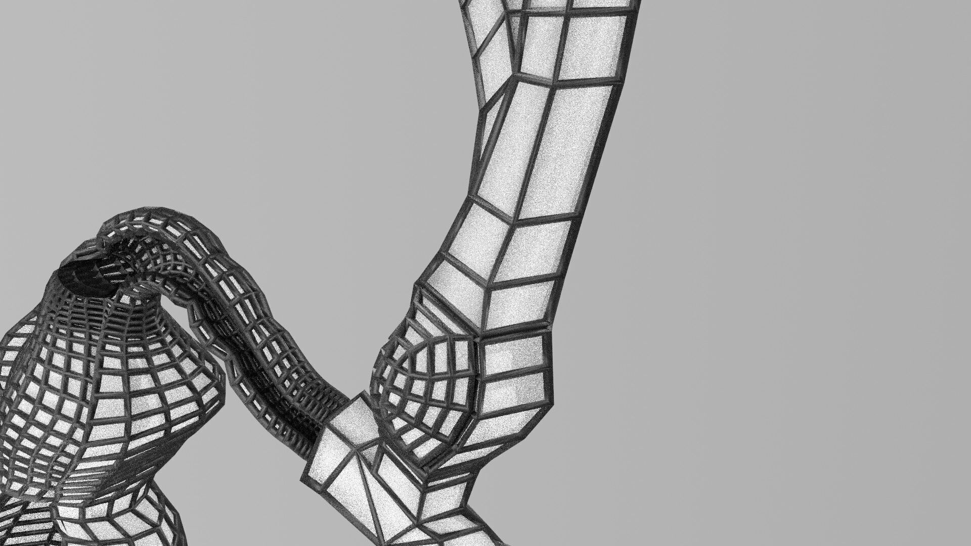 Biliary tract stone obstructions gallstone Low-poly 3D model_47