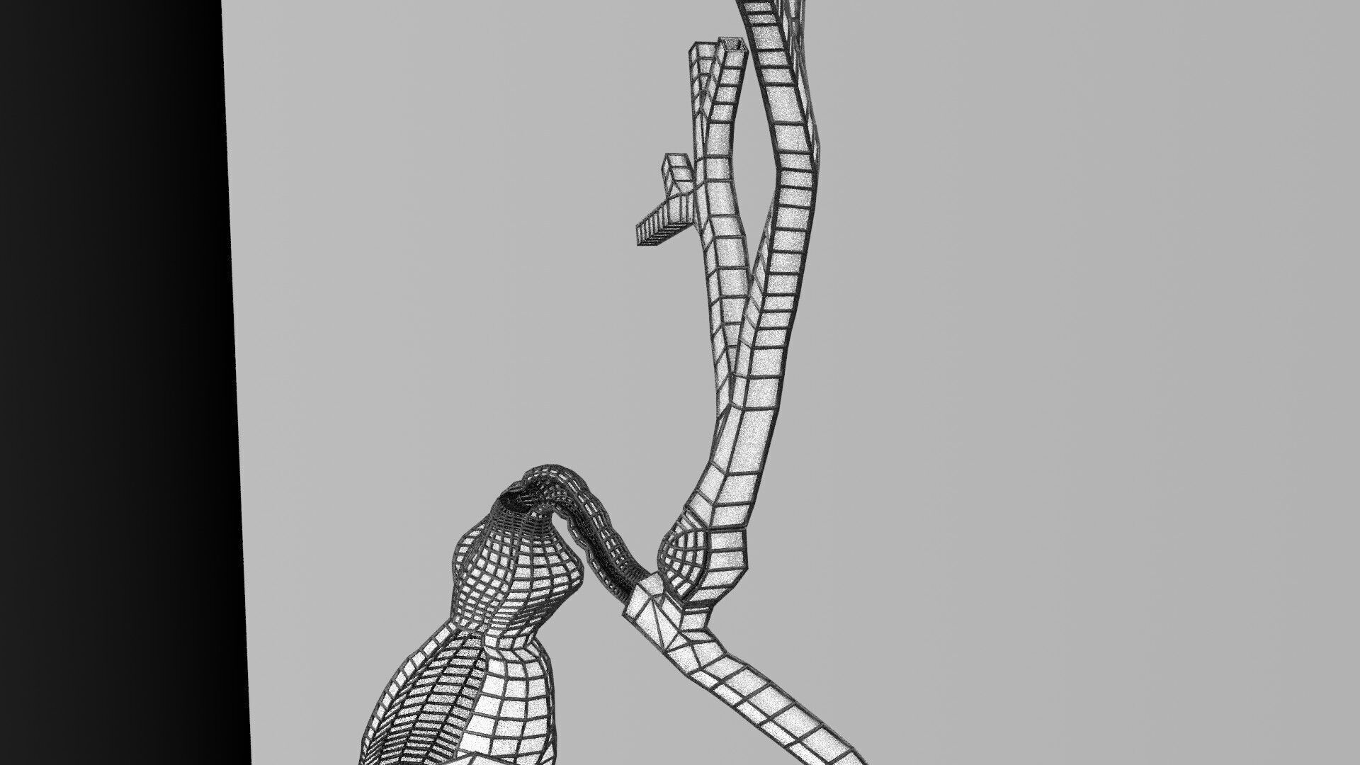 Biliary tract stone obstructions gallstone Low-poly 3D model_45