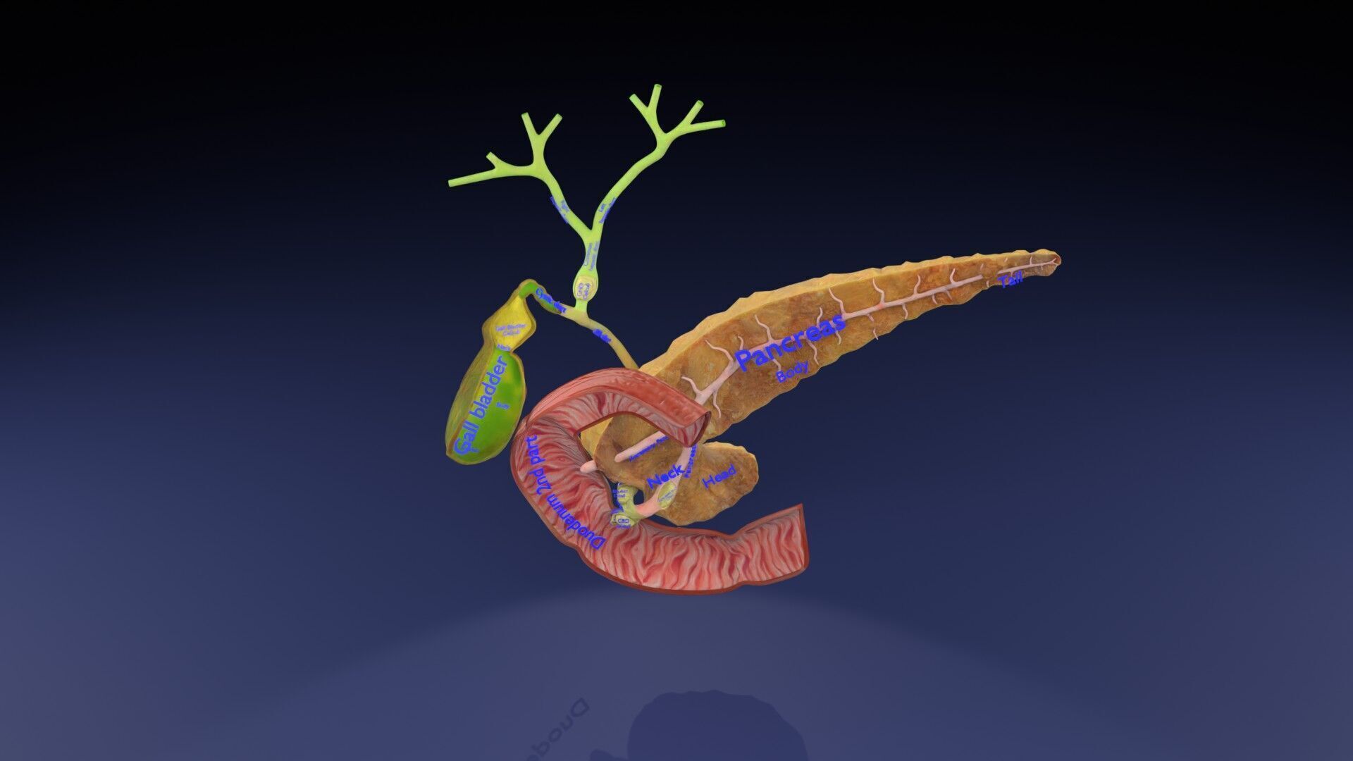 Biliary tract stone obstructions gallstone Low-poly 3D model_1