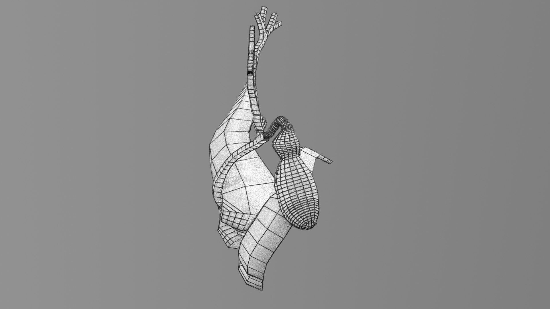 Biliary tract stone obstructions gallstone Low-poly 3D model_78