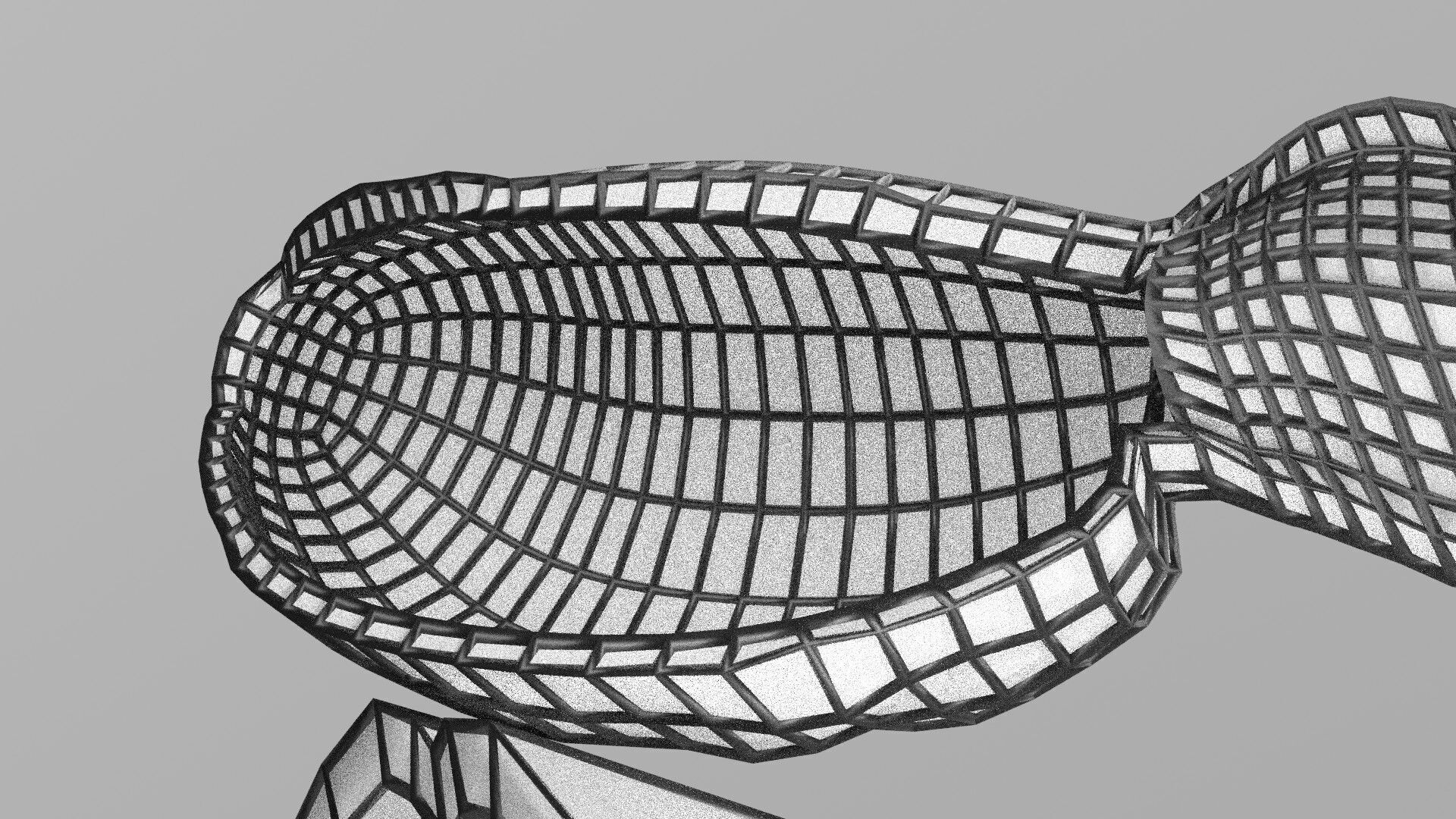 Biliary tract stone obstructions gallstone Low-poly 3D model_50