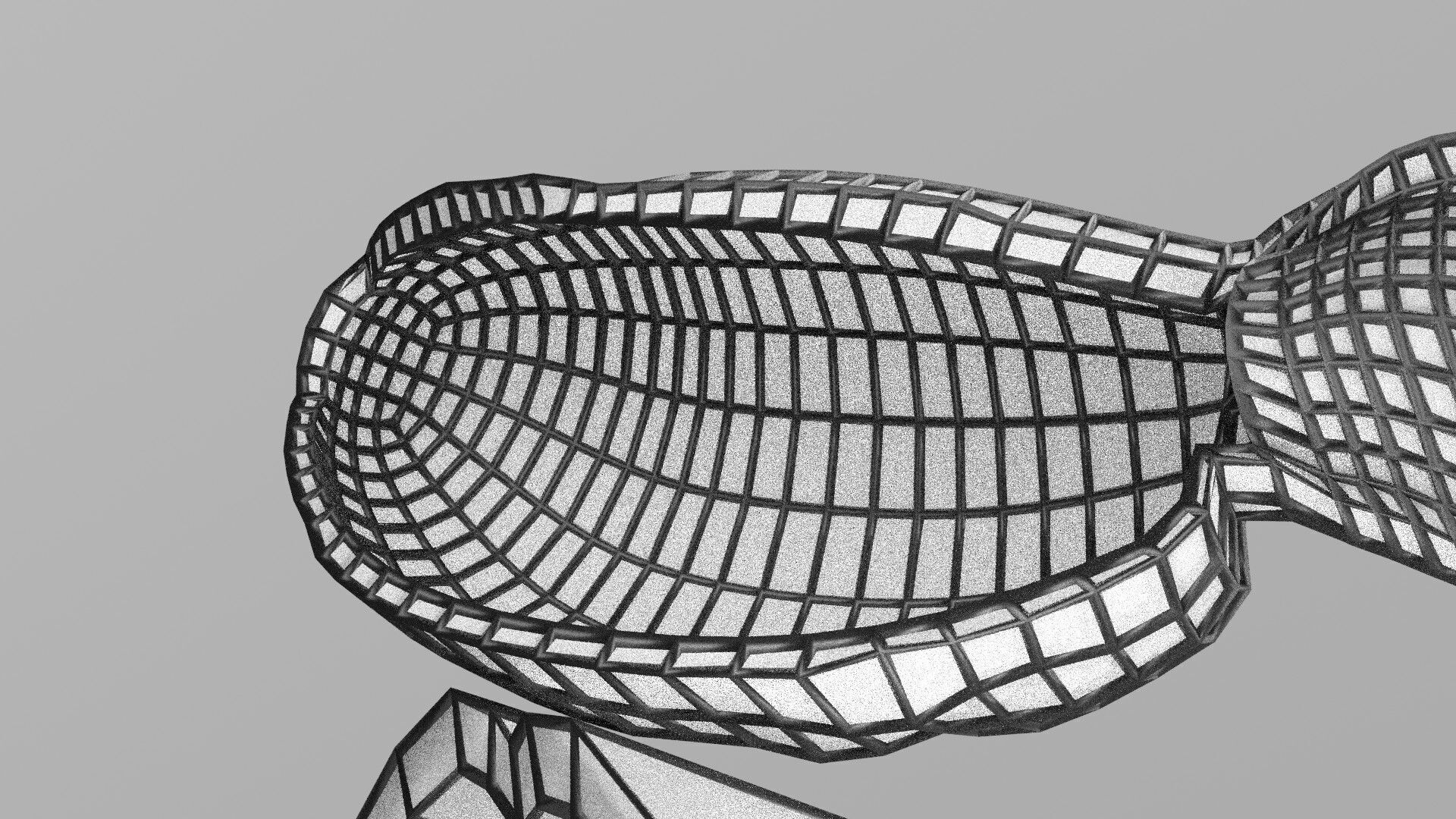 Biliary tract stone obstructions gallstone Low-poly 3D model_49