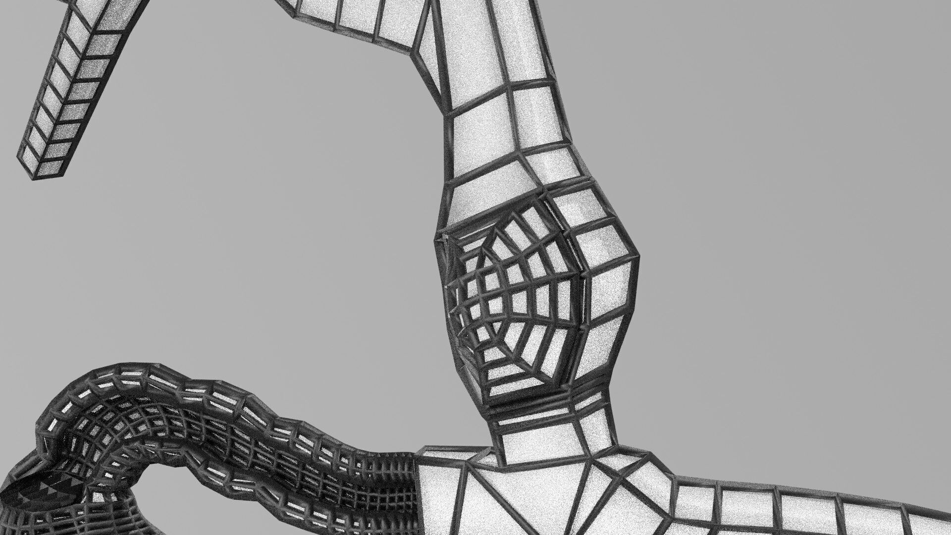 Biliary tract stone obstructions gallstone Low-poly 3D model_53