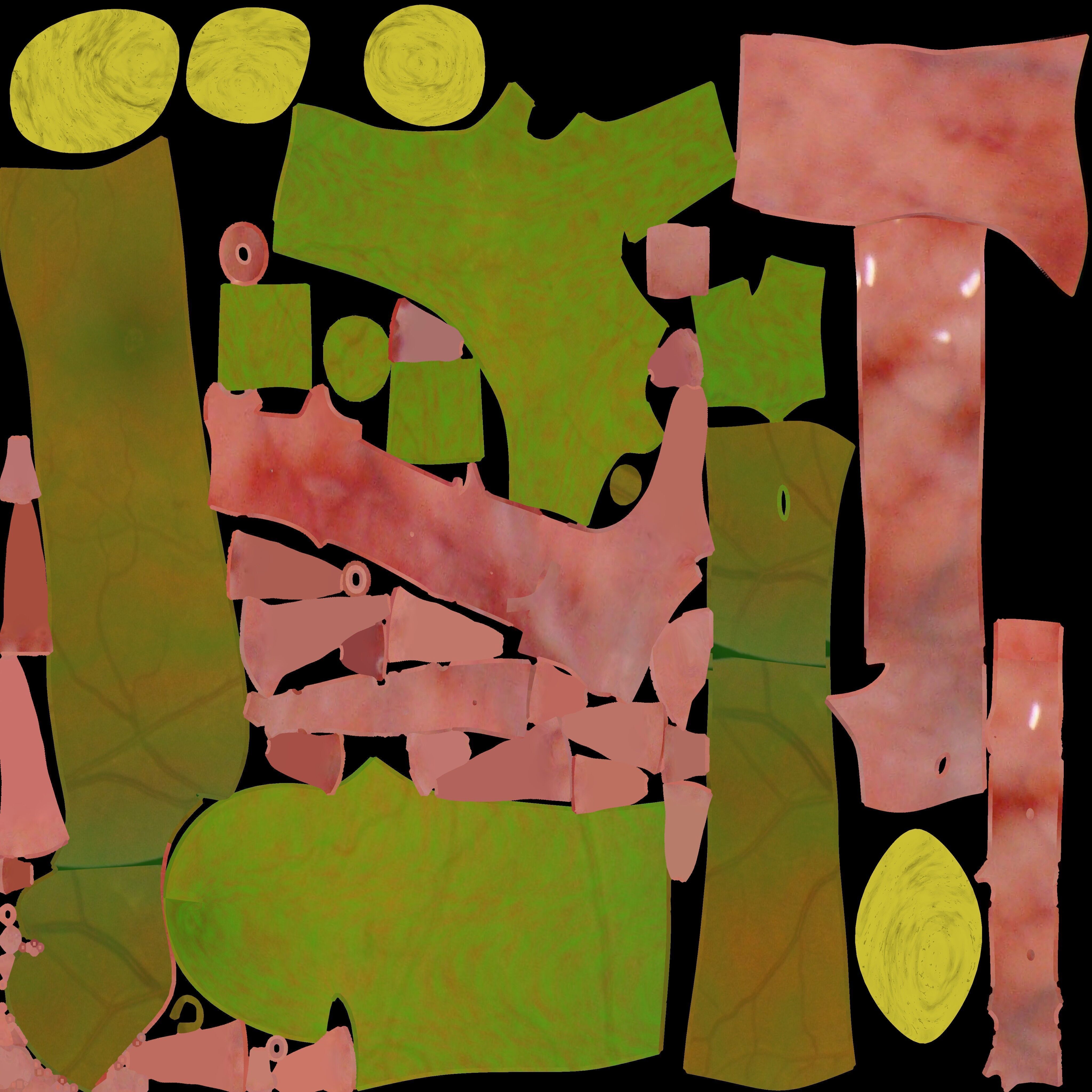 Biliary tract stone obstructions gallstone Low-poly 3D model_9